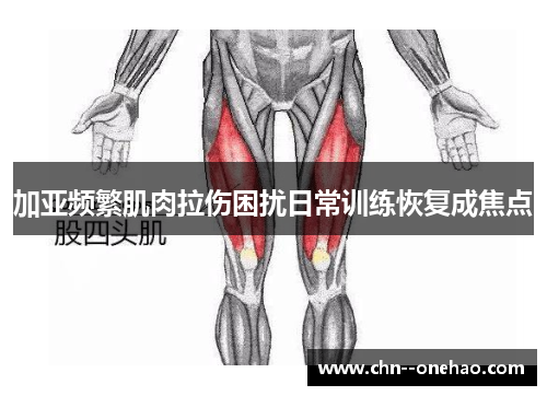 加亚频繁肌肉拉伤困扰日常训练恢复成焦点 加亚频繁肌肉拉伤困扰日常训练恢复成焦点